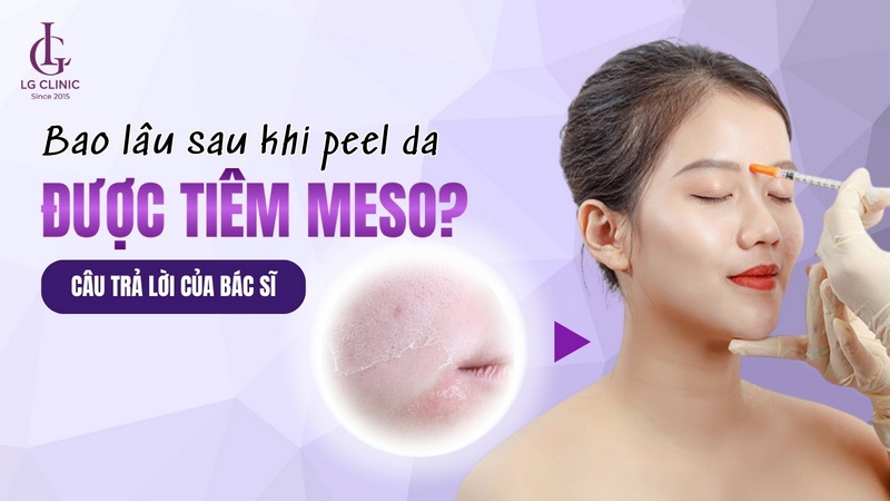 peel da bao lâu thì tiêm meso được