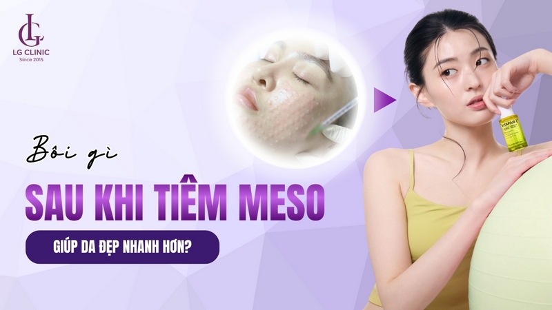 sau tiêm meso nên bôi gì