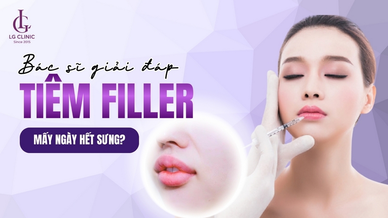 Tiêm filler mấy ngày hết sưng
