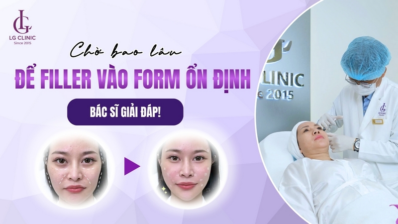 tiêm filler bao lâu thì vào form