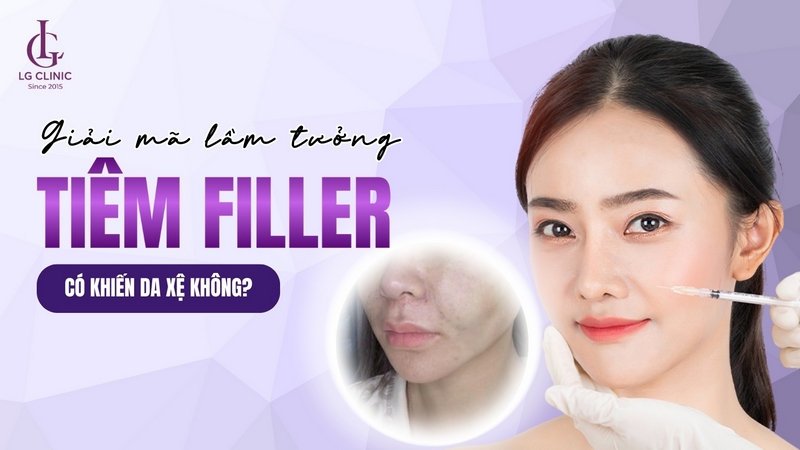 Tiêm filler có bị chảy xệ không