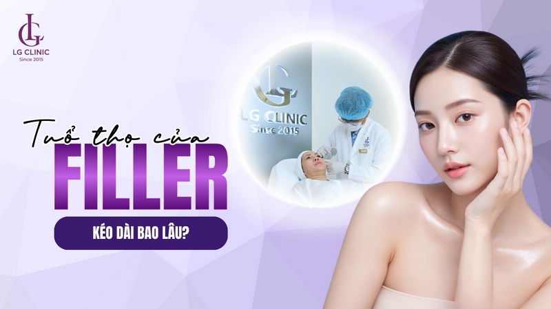 tiêm filler có tác dụng bao lâu