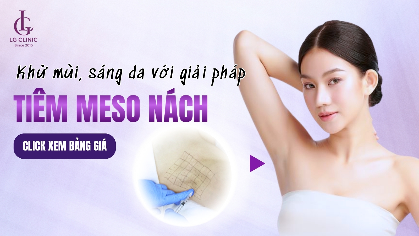 tiêm meso ức chế mồ hôi nách