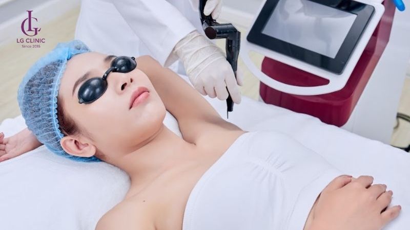 trị thâm nách bằng laser - cách trị thâm và hôi nách