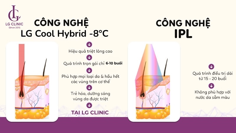 so sánh máy triệt lông và triệt lông tại spa