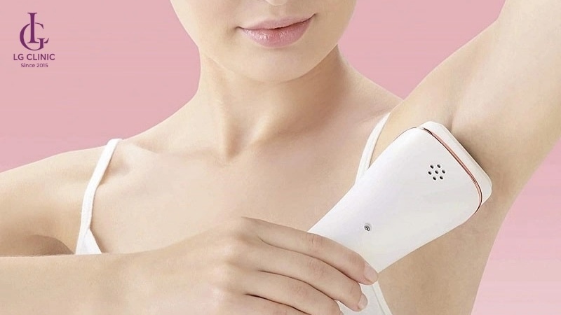máy triệt lông tại nhà