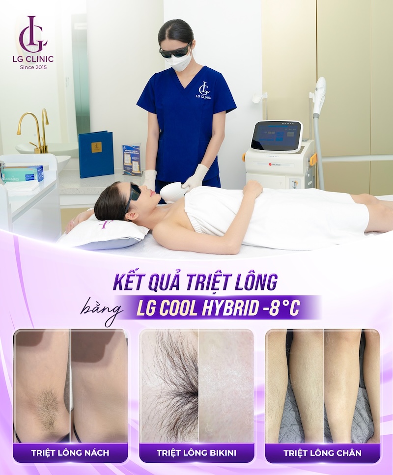 triệt lông trước sau