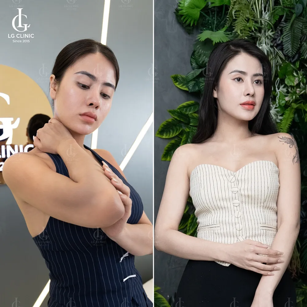 Hình ảnh BA tắm trắng