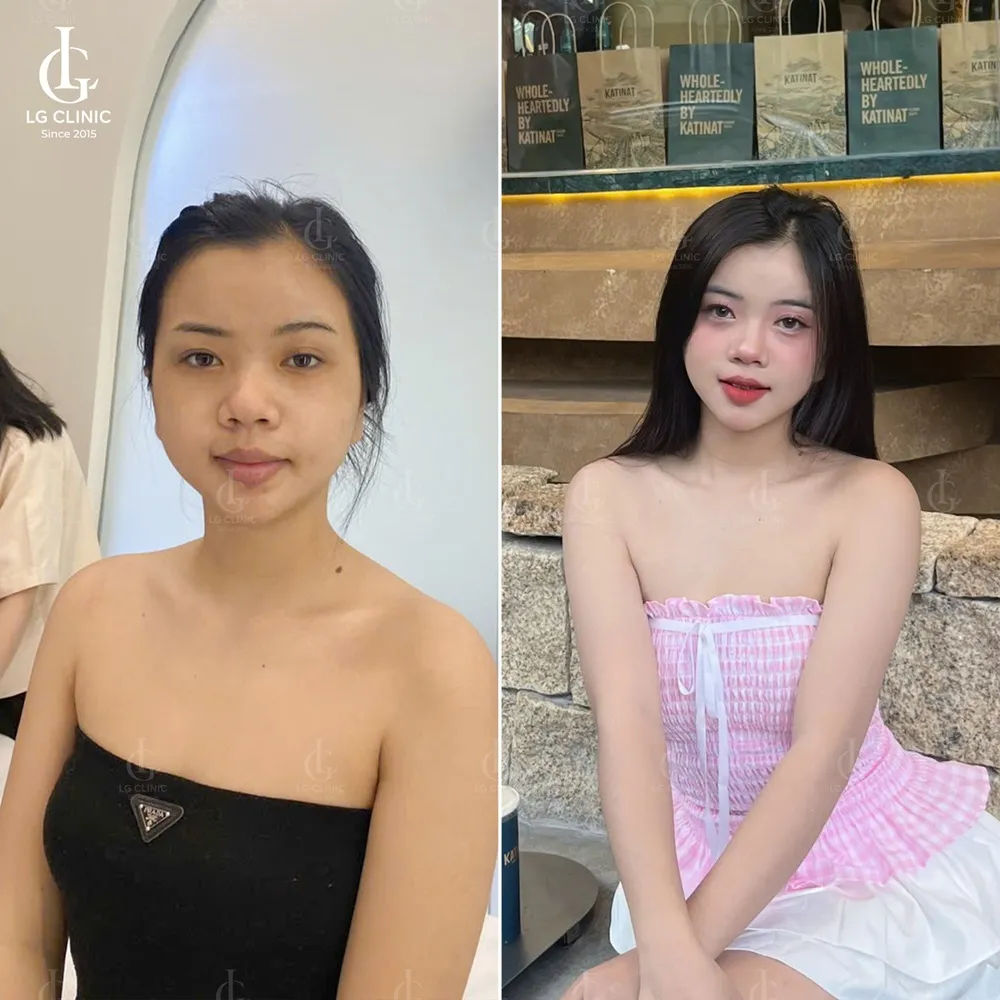 Hình ảnh BA tắm trắng