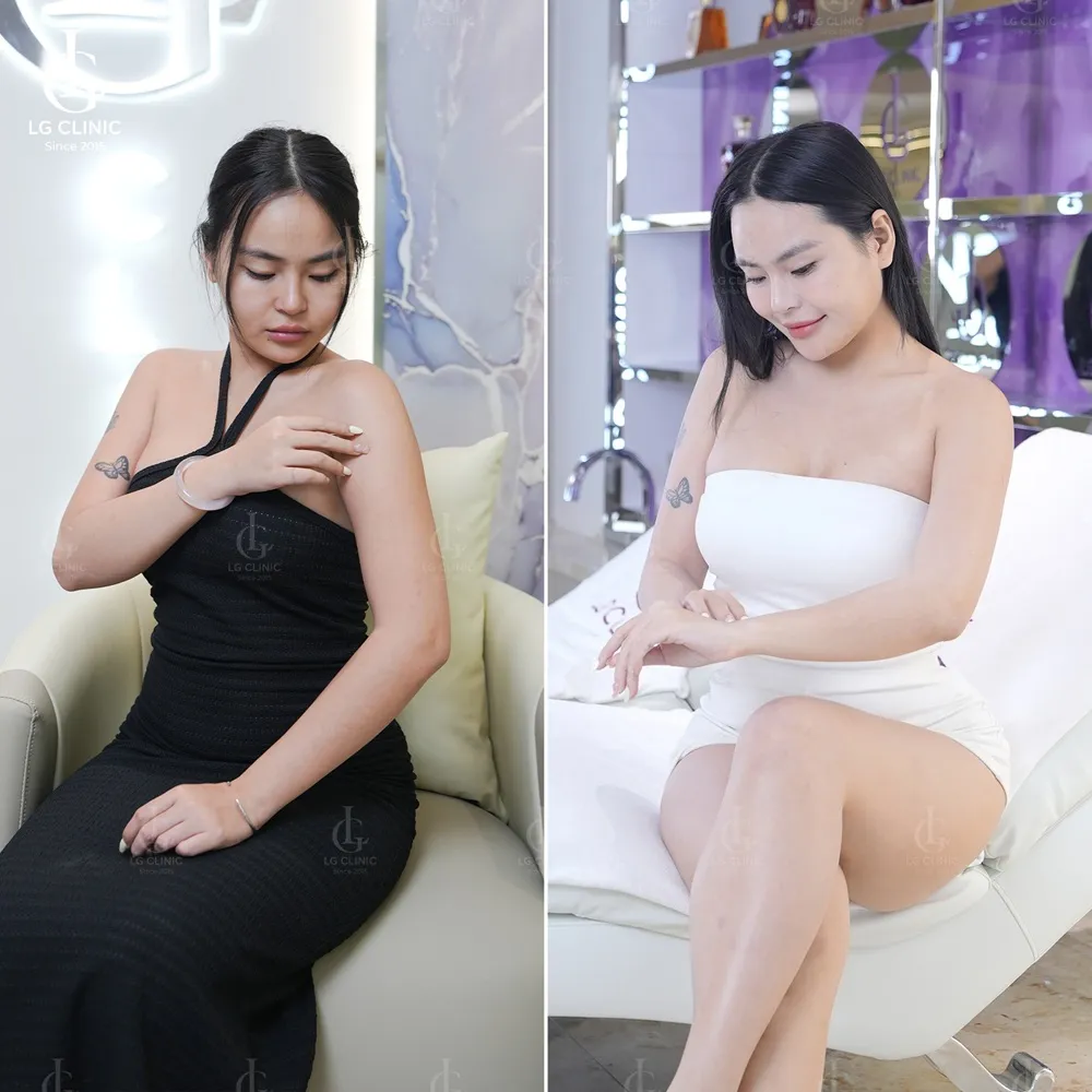 Hình ảnh BA tắm trắng