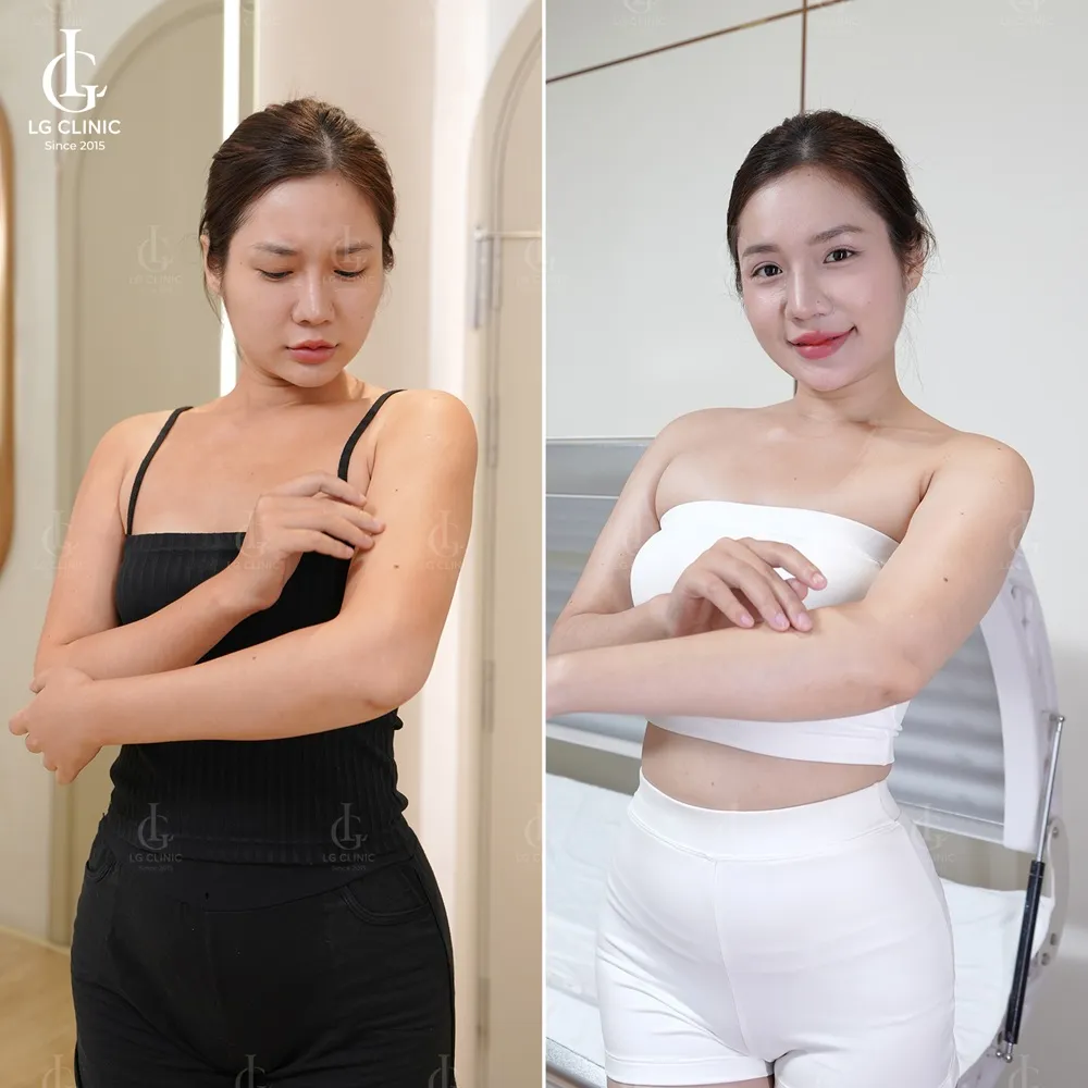 Hình ảnh BA tắm trắng