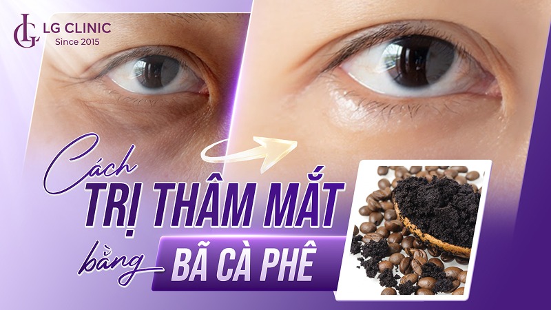 trị thâm mắt bằng bã cà phê
