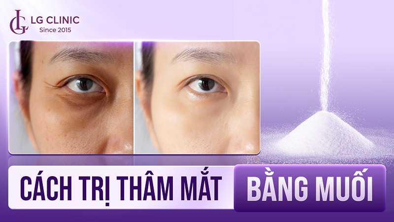 Trị thâm mắt bằng muối