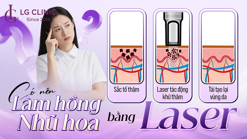 Có nên làm hồng nhũ hoa bằng laser
