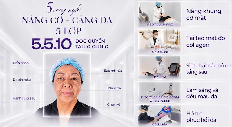 5 công nghệ nâng cơ căng da 5 lớp