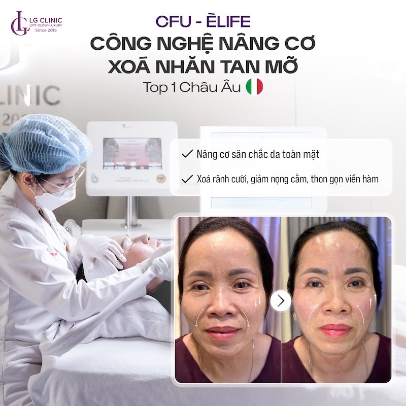 nâng cơ trẻ hoá da cfu èlife