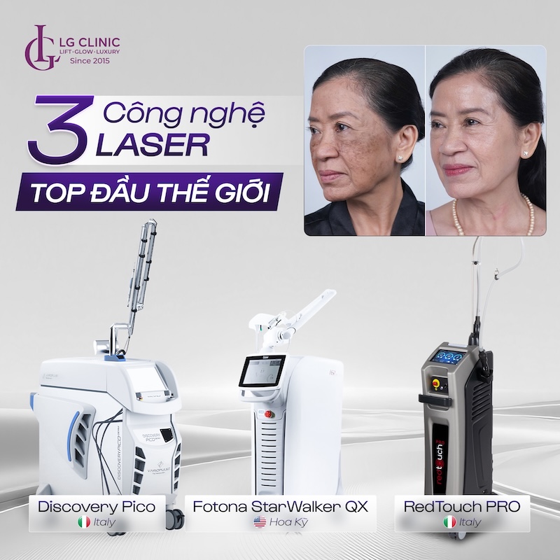 trẻ hoá da bằng laser