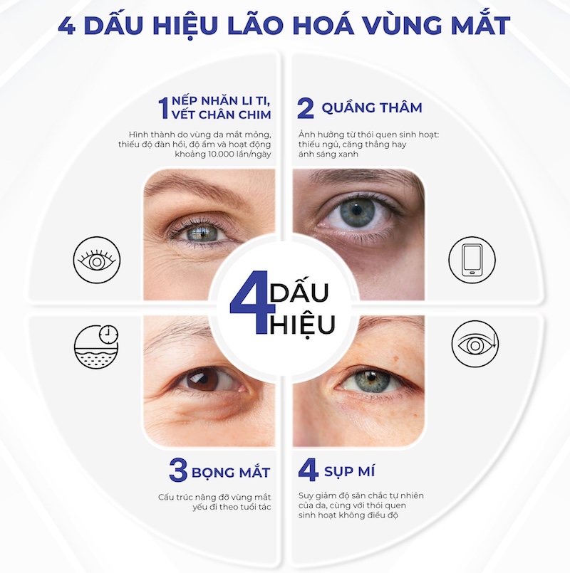 dấu hiệu mắt lão hoá