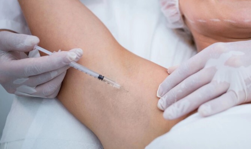 botox vùng nách