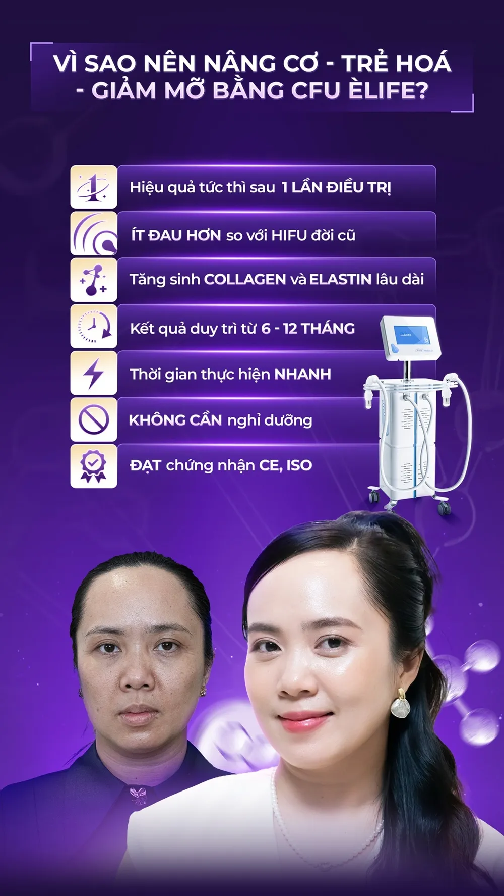 vì sao nên nâng cơ trẻ hóa giảm mỡ bằng CFU Èlife