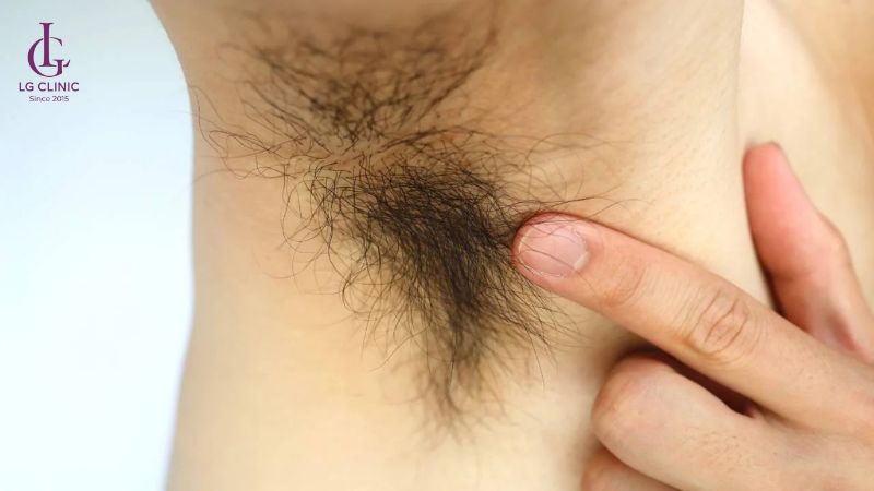 không mọc lông nách có sao không