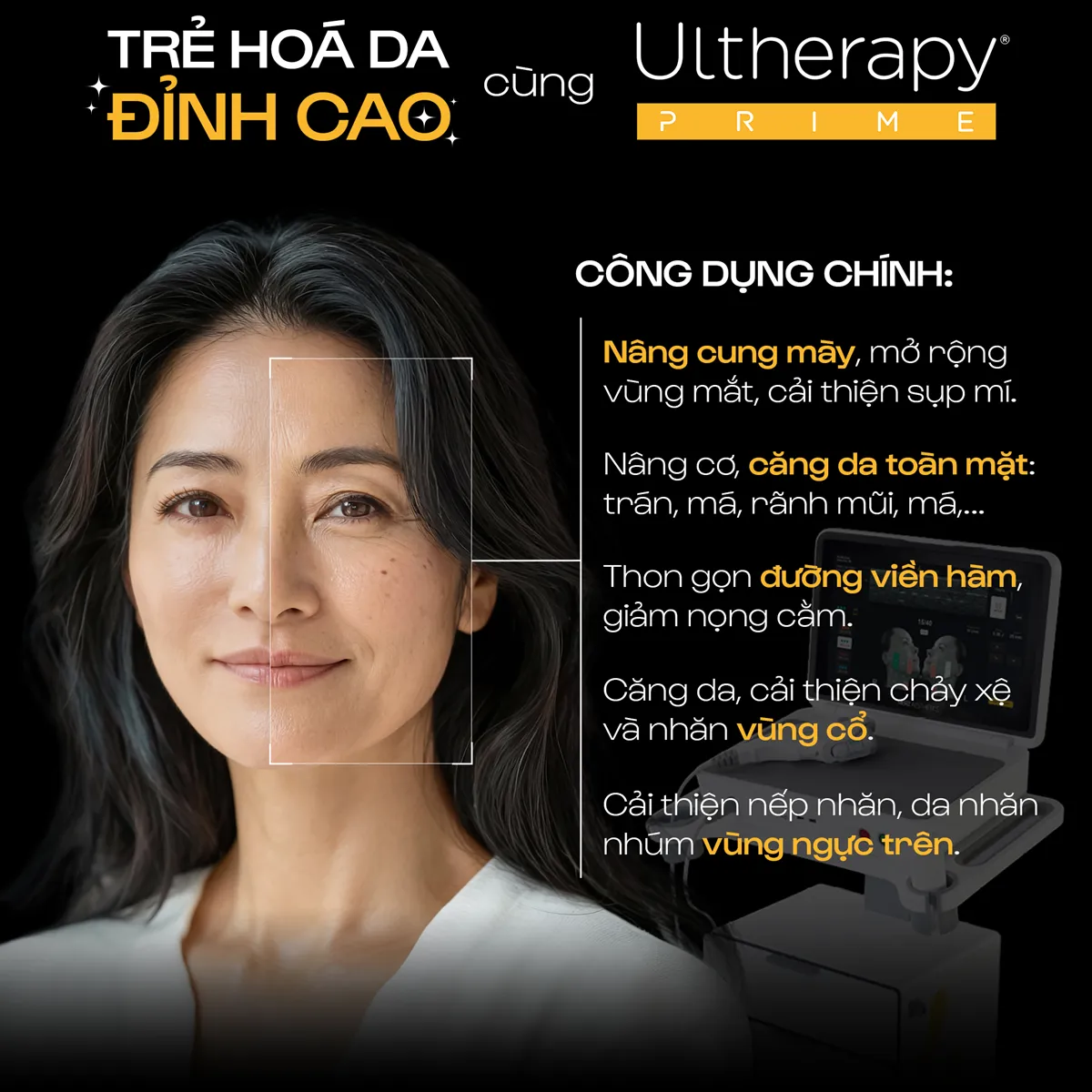Landing page Ultherapy Prime 02 MB
