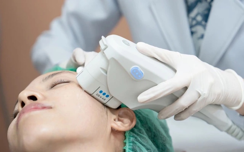 ultherapy