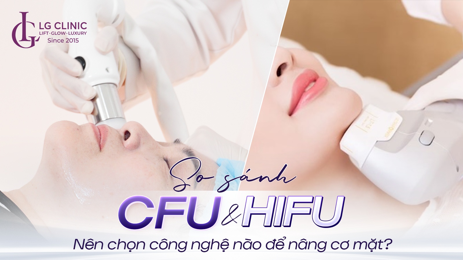 So sánh công nghệ nâng cơ CFU và HIFU