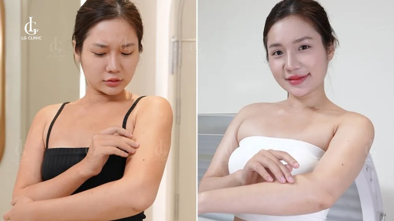Spa tắm trắng quận 3