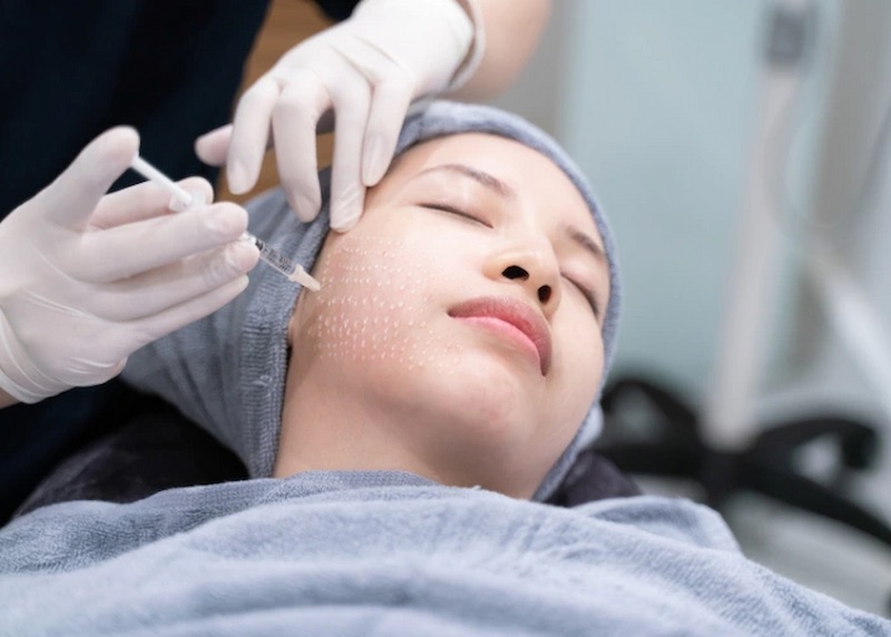 Tiêm cấy trực tiếp tế bào gốc