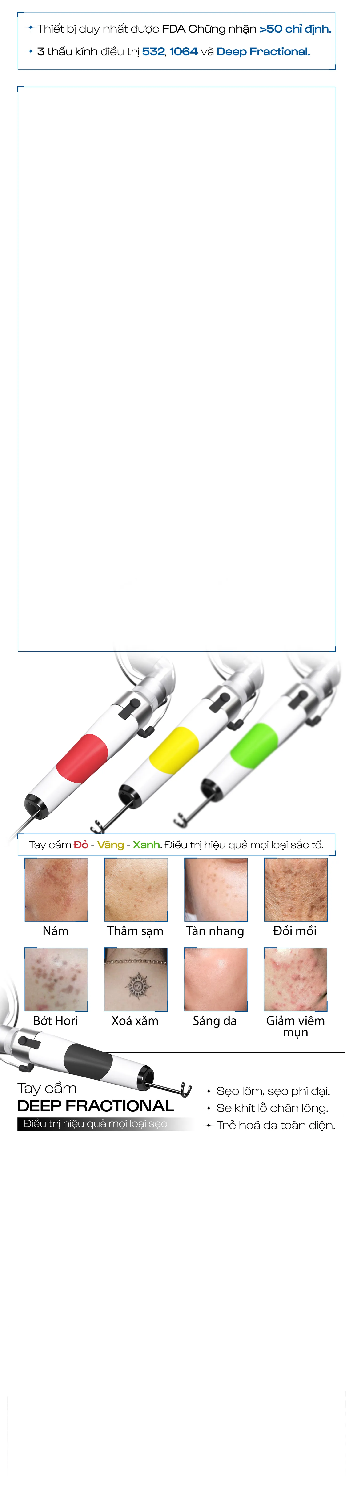 Banner công dụng Discovery MB