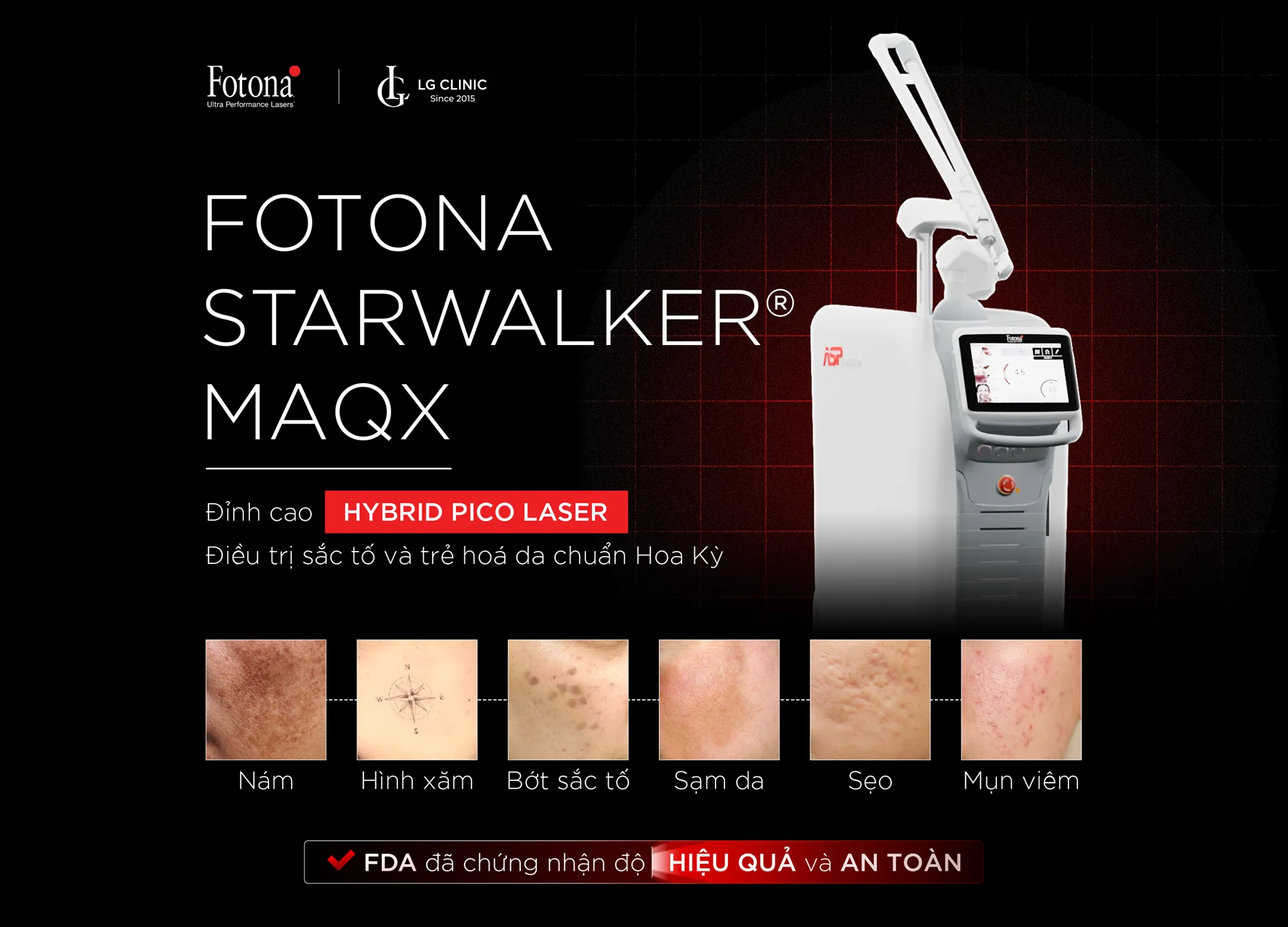 Banner Fotona 01 PC