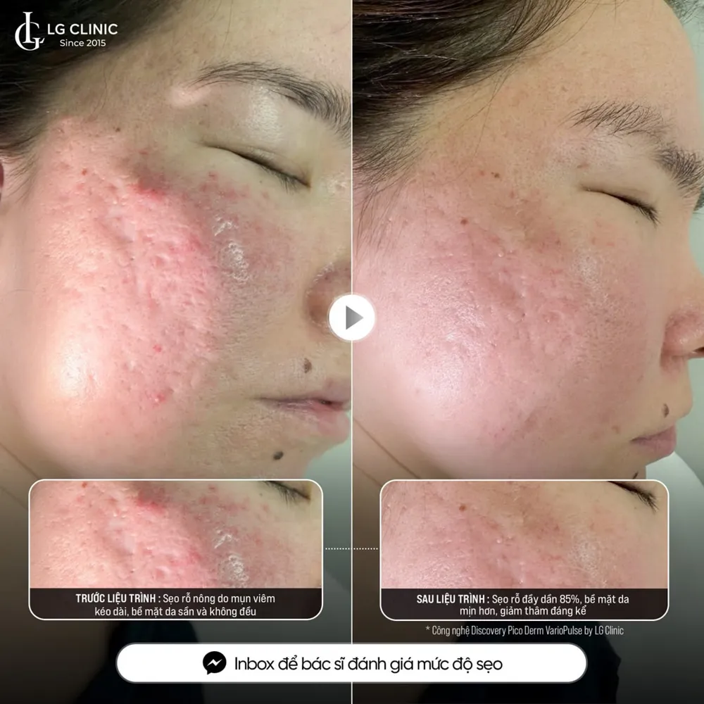 Hình ảnh ba Discovery 01
