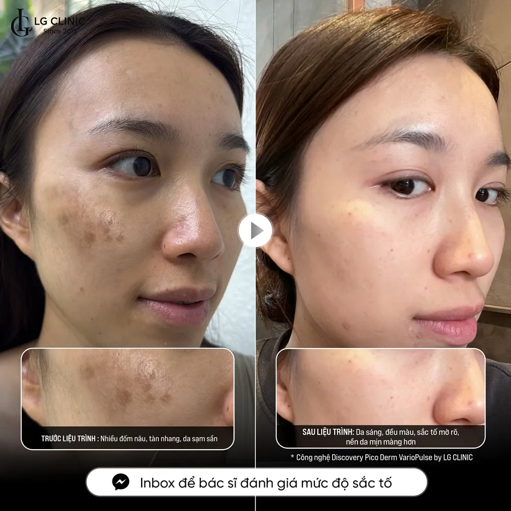 Hình ảnh ba Discovery 02