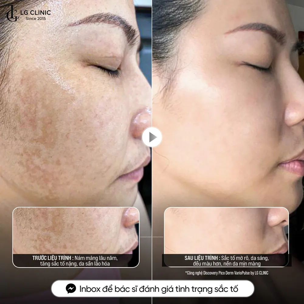Hình ảnh ba Discovery 03