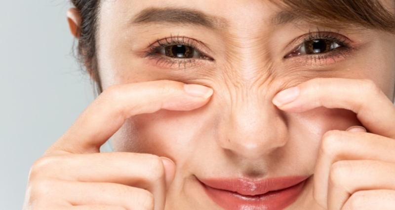 nếp nhăn dưới mắt