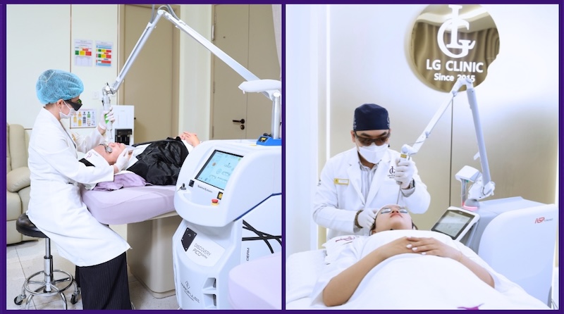 xoá nếp nhăn mũi bằng laser