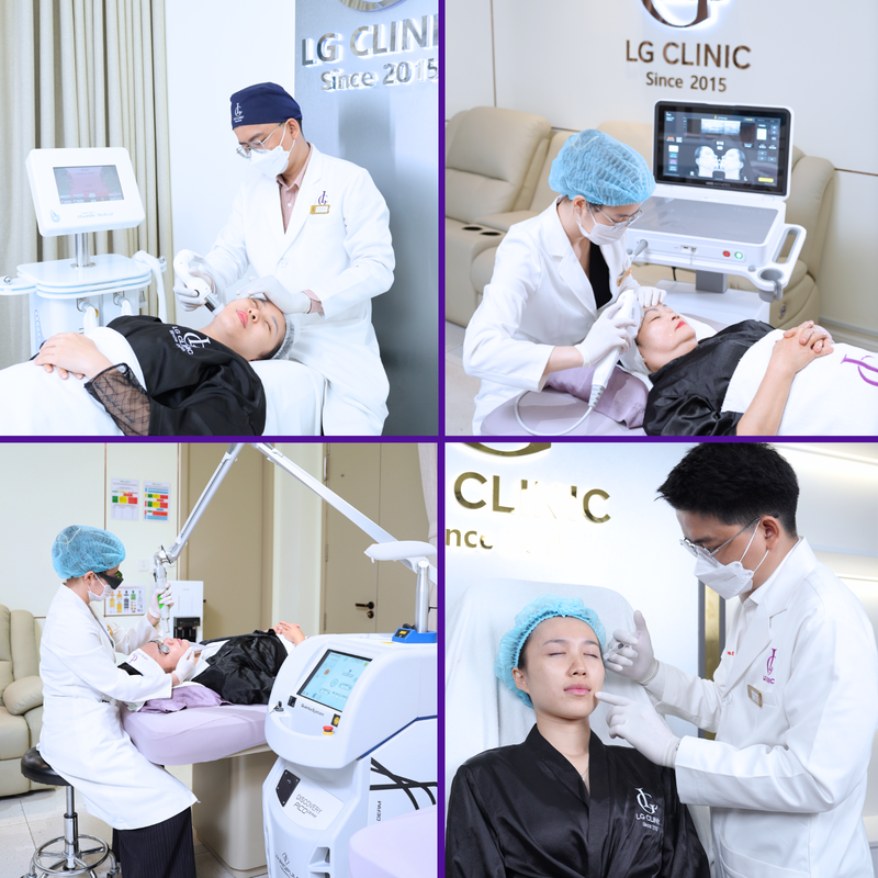 xoá nếp nhăn vùng mắt