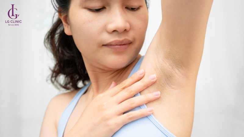 tại sao lông nách mọc ít