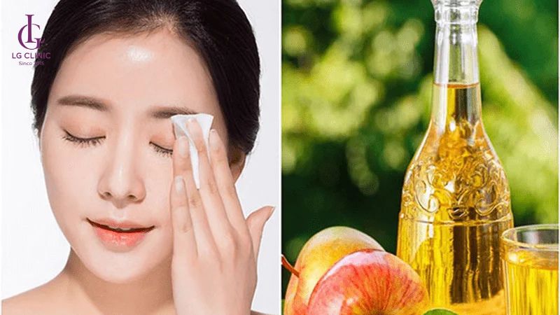 Trị thâm bằng giấm táo
