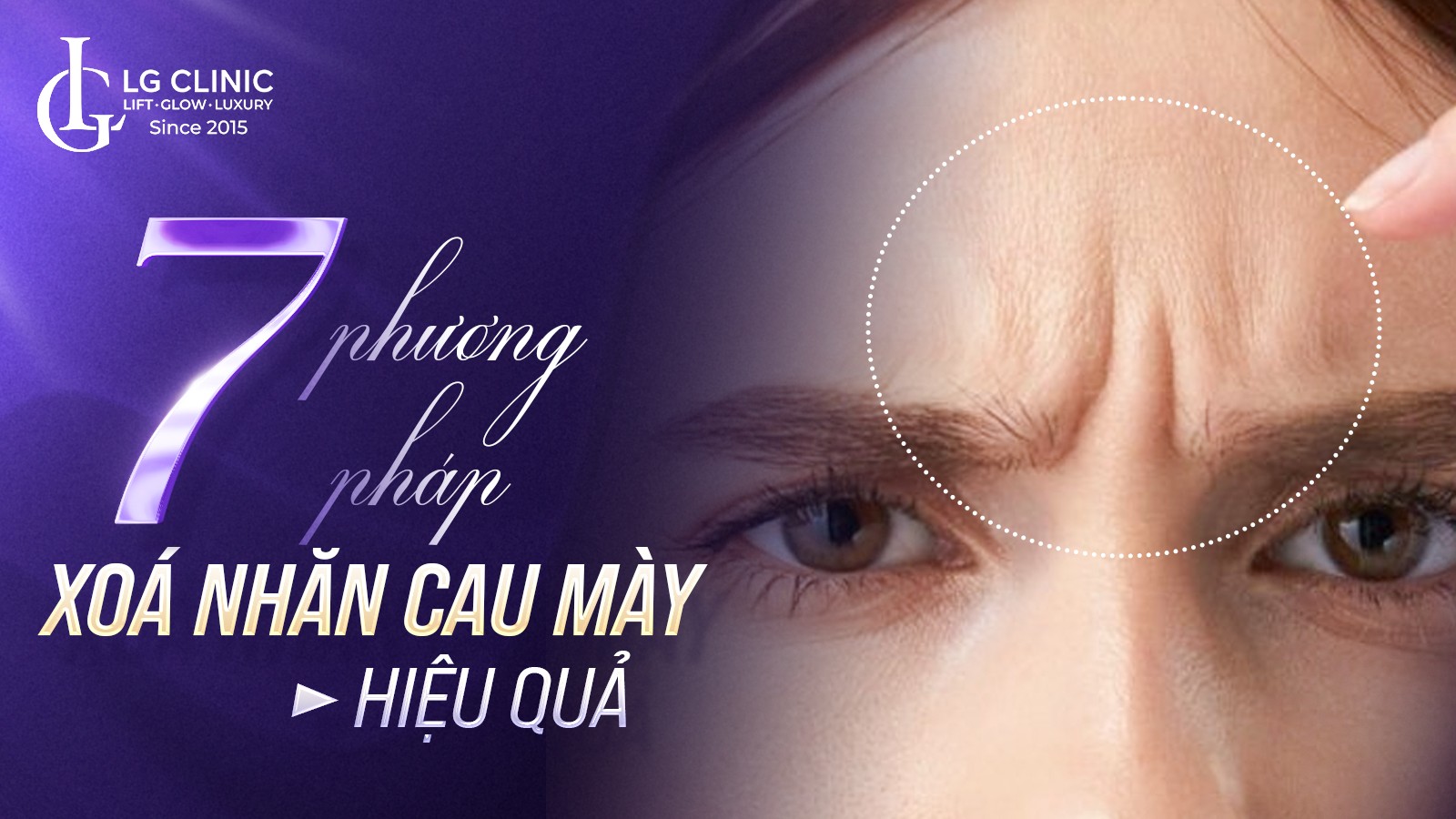 Phương pháp xóa nhăn cau mày hiệu quả lấy lại vẻ tươi trẻ