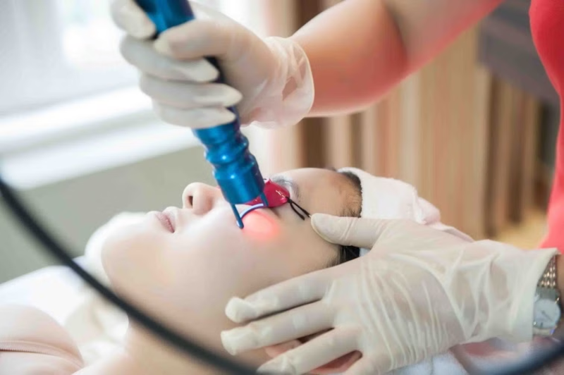 laser trẻ hoá vùng mắt