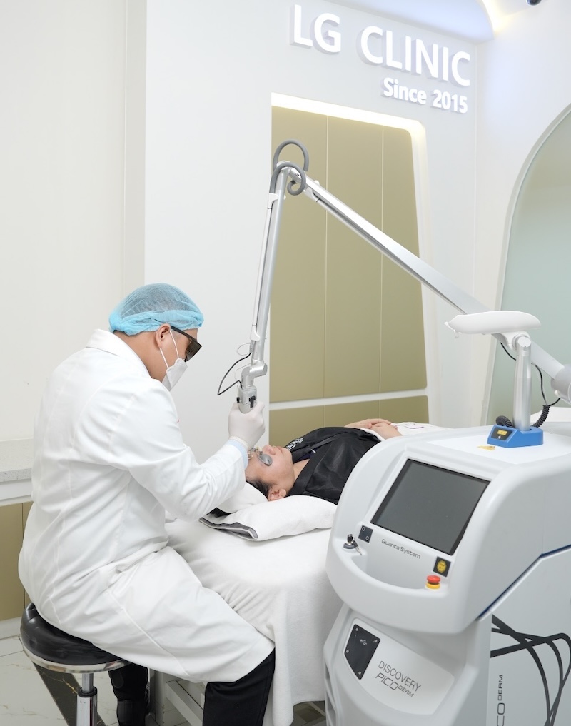 bắn laser xoá nếp nhăn rãnh cười