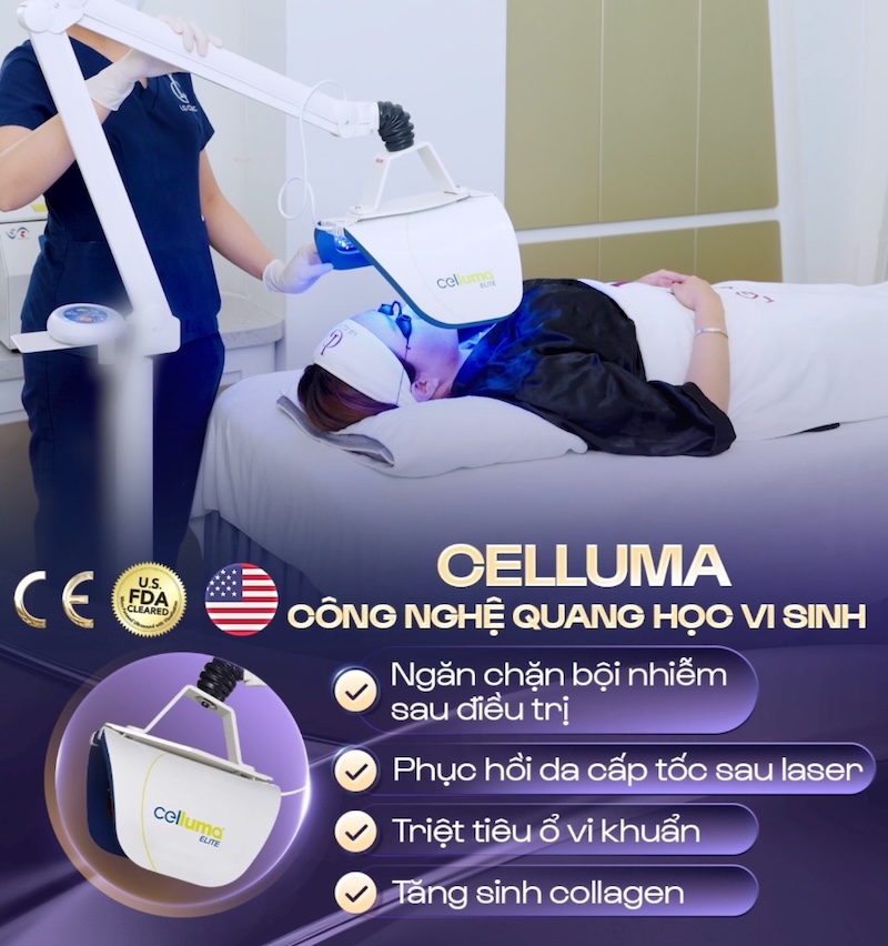 đèn quang học celluma