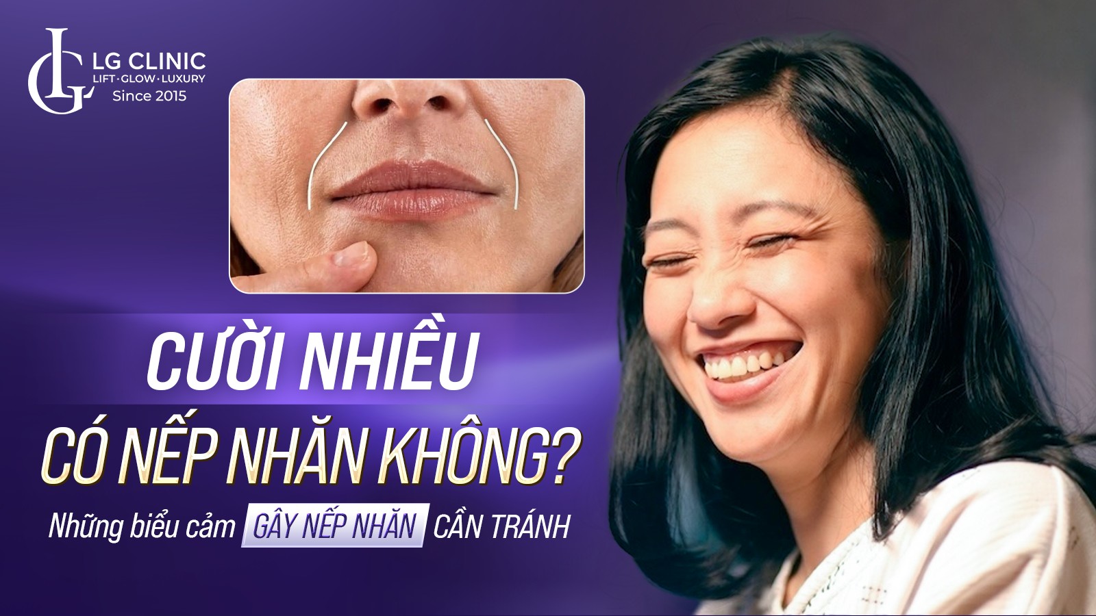Cười nhiều có nếp nhăn không? Những biểu cảm gây nếp nhăn cần tránh