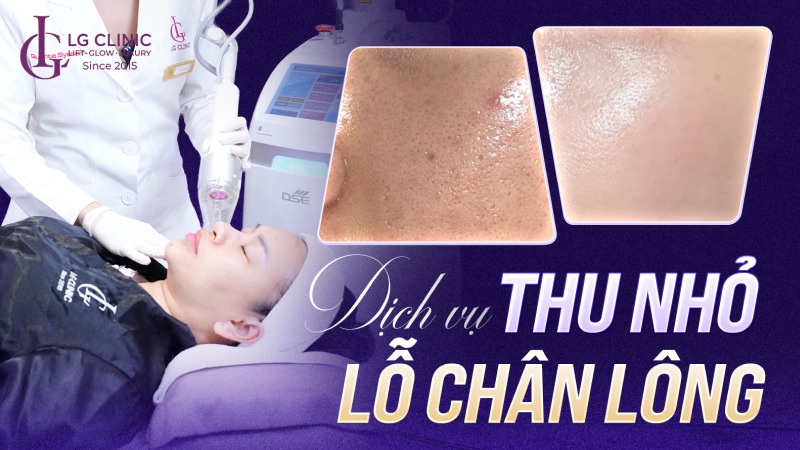 dịch vụ thu nhỏ lỗ chân lông