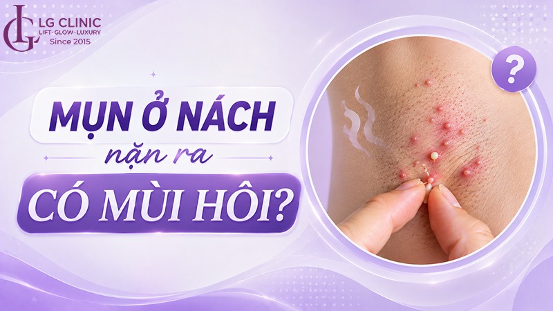 mụn ở nách nặn ra có mùi hôi