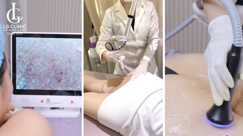 Spa trị thâm quận 12