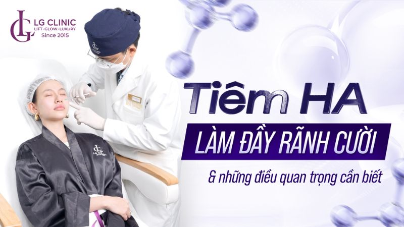 Tiêm HA làm đầy rãnh cười