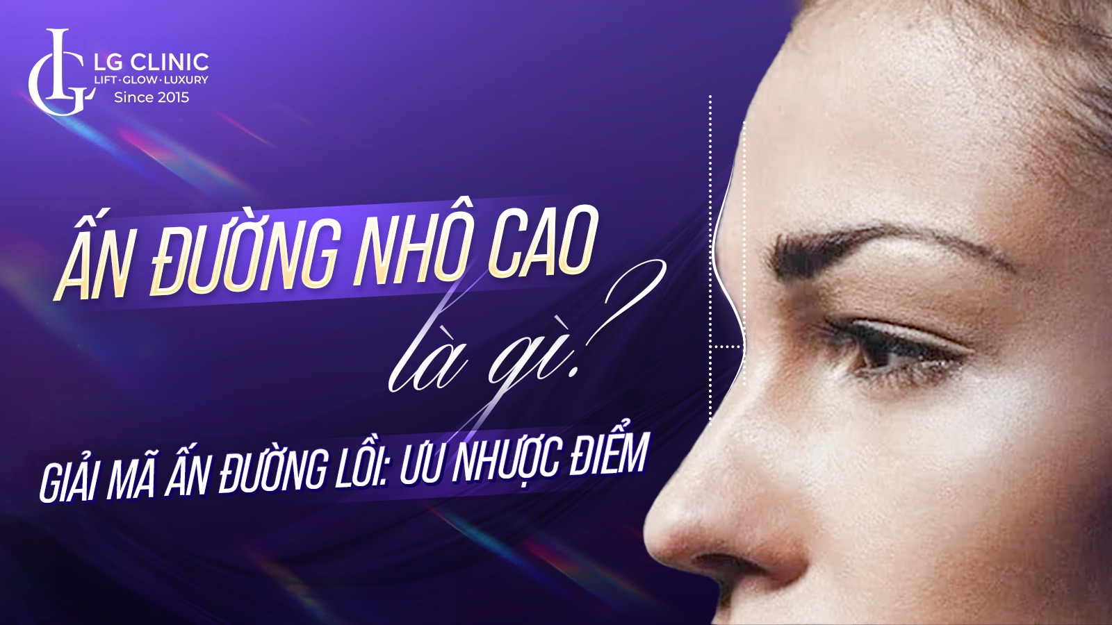 Ấn đường nhô cao là gì